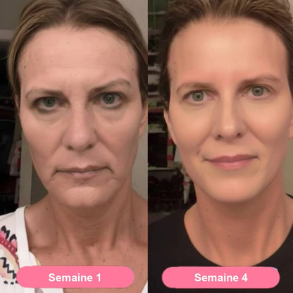 Week 1 / week 4