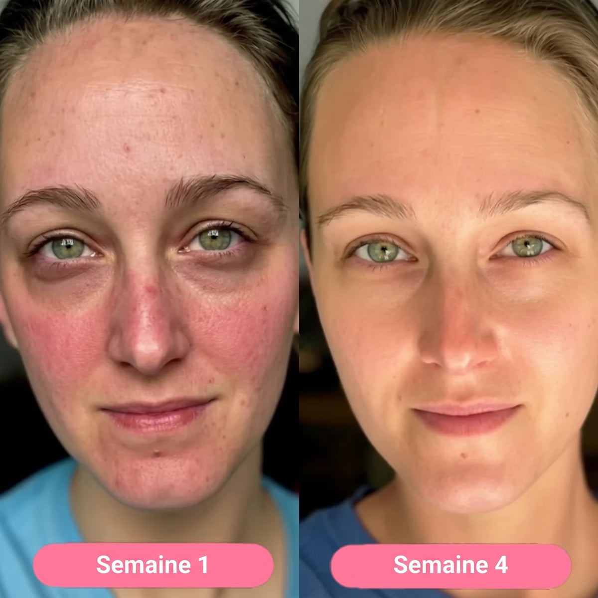 Week 1 / week 4