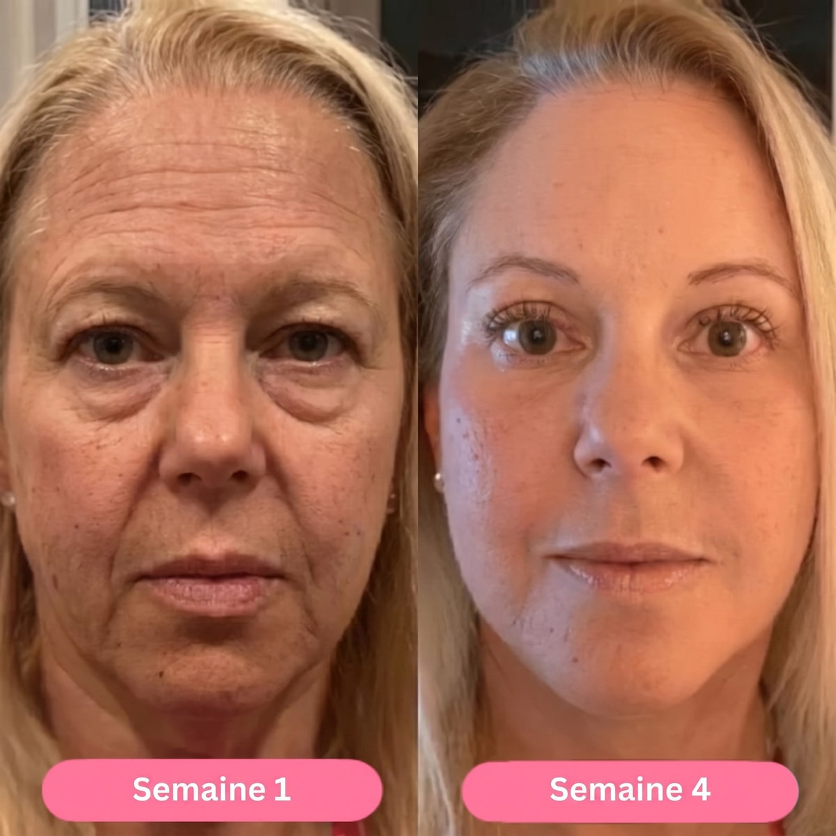 Week 1 / week 4