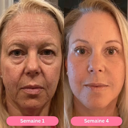 Week 1 / week 4
